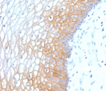 Recombinant E-Cadherin Antibody / Rabbit Monoclonal