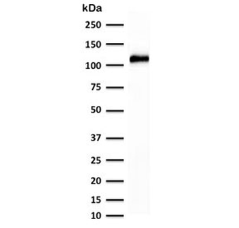 Recombinant Cadherin 16 Antibody / Rabbit Monoclonal