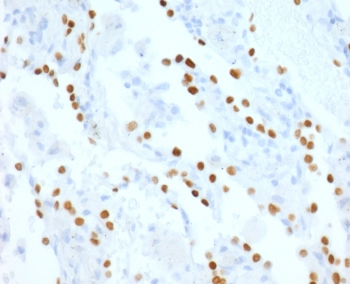 Recombinant NKX2.1 Antibody / TTF-1 Rabbit Monoclonal