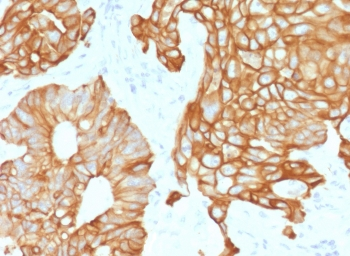 Recombinant Cytokeratin 19 Antibody / Rabbit Monoclonal