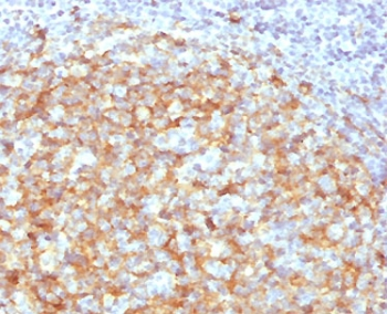 CD14 Antibody (Macrophage Marker)
