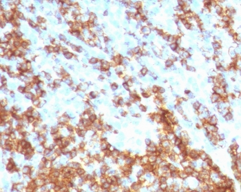 CD45RB Antibody (B-cell marker)