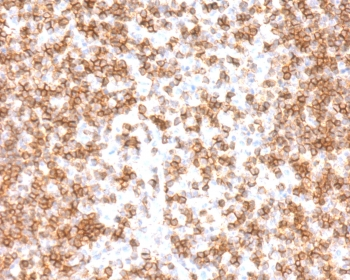 Recombinant CD45 Antibody / Rabbit Monoclonal