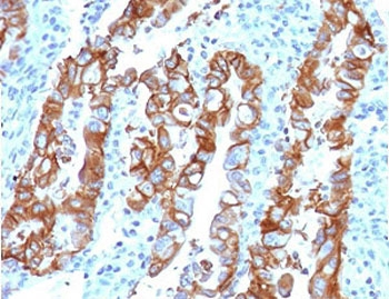 TROP2 Antibody / TACSTD2
