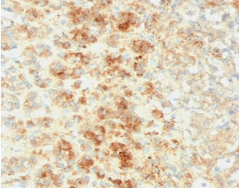 Recombinant Perilipin 2 Antibody / PLIN2 / Adipophilin / ADRP