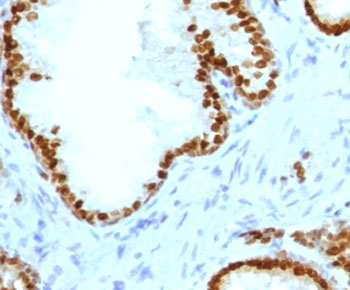 Recombinant ATRX Antibody / RAD54