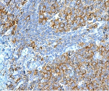 RPSA Antibody / 40S Ribosomal protein SA / Laminin Receptor 1