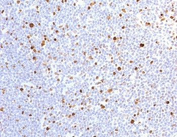 Recombinant MCM7 Antibody