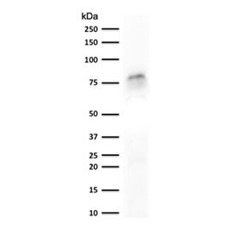 Recombinant MCM7 Antibody