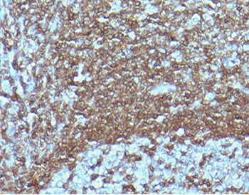 Recombinant CD6 Antibody