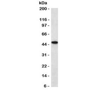 Recombinant Keratin 18 Antibody / Cytokeratin 18