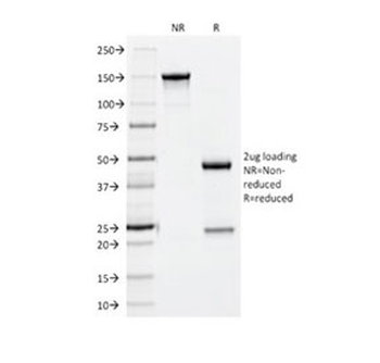 NCAM / CD56 Antibody