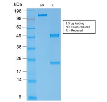 Recombinant Spectrin alpha 1 Antibody / SPTA1