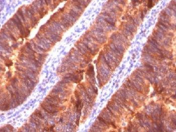 MUC1 Antibody / Mucin-1 / EMA