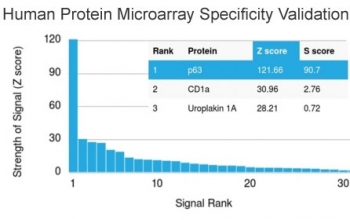 p63 Antibody / Tumor protein 63