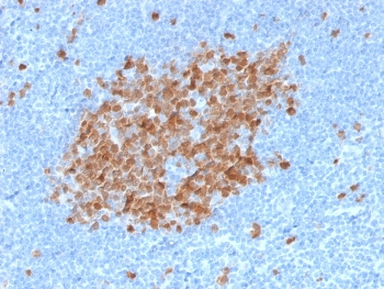 TYMS Antibody / Thymidylate Synthase