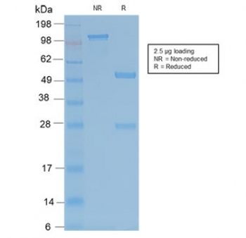 Recombinant TRAcP Antibody / TRAP / ACP5