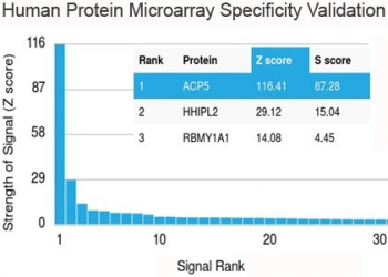 Recombinant TRAcP Antibody / TRAP / ACP5