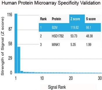 Recombinant Beta-2 Microglobulin Antibody