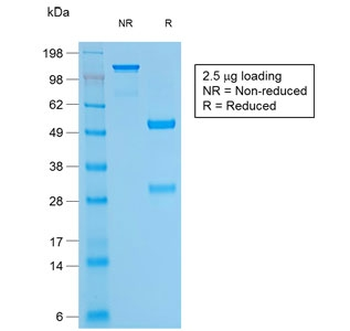Recombinant Bcl2 Antibody / Rabbit Monoclonal