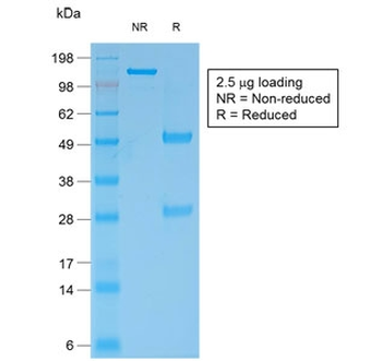 Recombinant Bcl-2 Antibody