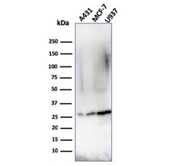 Recombinant Bcl-2 Antibody