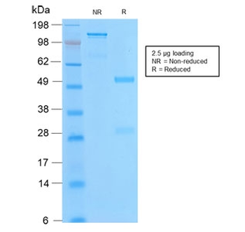Recombinant Bcl-2 Antibody / Rabbit Monoclonal