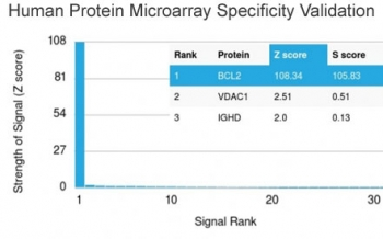 Recombinant Bcl-2 Antibody / Rabbit Monoclonal