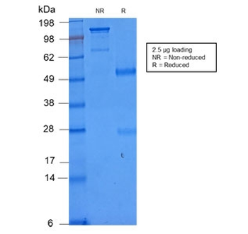 Recombinant CD86 Antibody