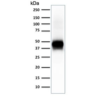 Recombinant EpCAM Antibody / Extracellular domain
