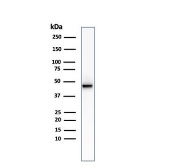 Recombinant Cytokeratin 8 Antibody / Rabbit Monoclonal