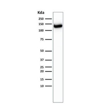 Recombinant E-Cadherin Antibody / Rabbit Monoclonal
