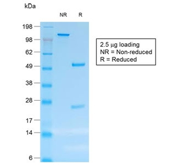 Recombinant CD30 Antibody
