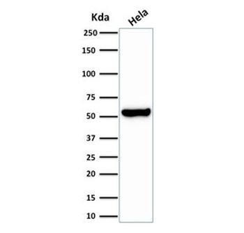 Recombinant HSP60 Antibody / Rabbit Monoclonal