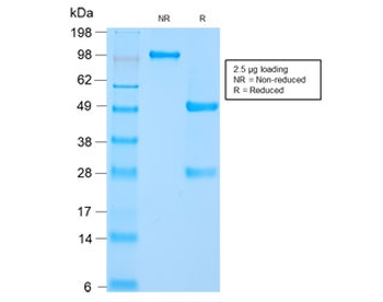 Recombinant HSP60 Antibody / Rabbit Monoclonal
