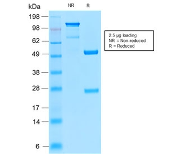 Recombinant CD52 Antibody