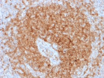 Recombinant CD79a Antibody