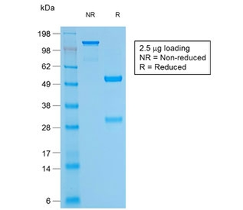 Recombinant CD79a Antibody