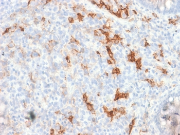 Recombinant p75NTR Antibody / NGFR