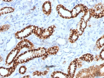 Recombinant Cadherin 16 Antibody