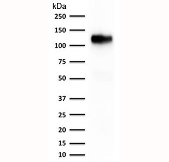 Recombinant Cadherin 16 Antibody
