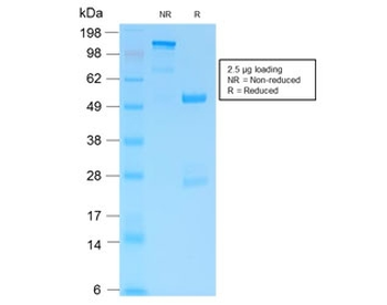 Recombinant GFAP Antibody / Rabbit Monoclonal