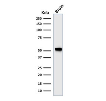 Recombinant Glial Fibrillary Acidic Protein Antibody