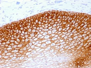 Recombinant CD44v4 Antibody