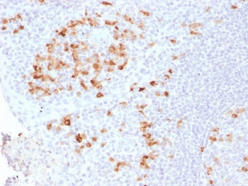 Recombinant Kappa Antibody / Rabbit Monoclonal