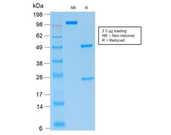 Recombinant PAX5 Antibody