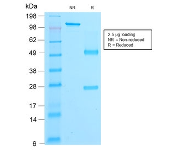Recombinant Beta Catenin Antibody