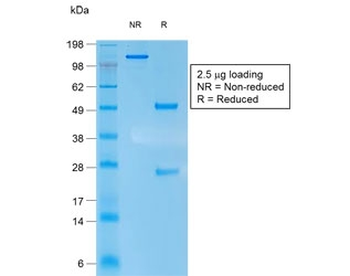 Recombinant Keratin 10 Antibody