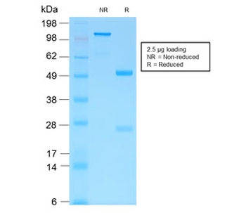 Recombinant HCG-beta Antibody / Rabbit Monoclonal
