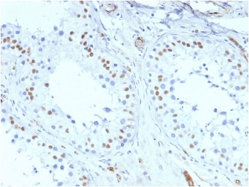 Recombinant WT1 Antibody / Wilm's Tumor